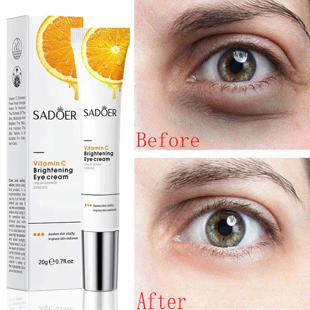 SADOER Vitamin C Eye Cream 20g - Sadoer PureSkin