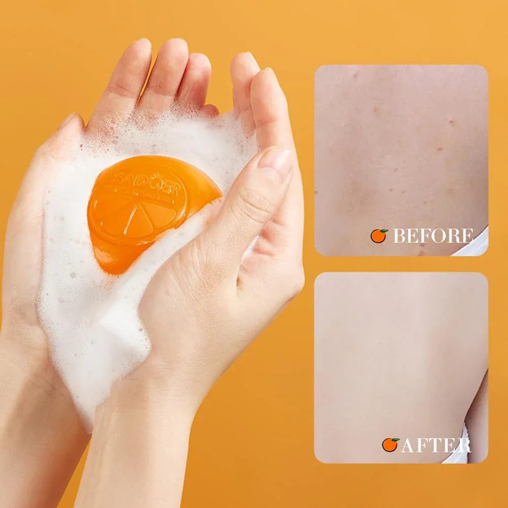 SADOER Vitamin C Soap (Including Foaming Net) - Sadoer PureSkin